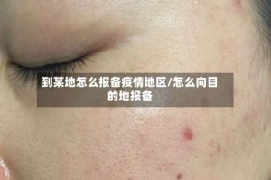 到某地怎么报备疫情地区/怎么向目的地报备
