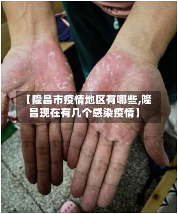 【隆昌市疫情地区有哪些,隆昌现在有几个感染疫情】-第3张图片